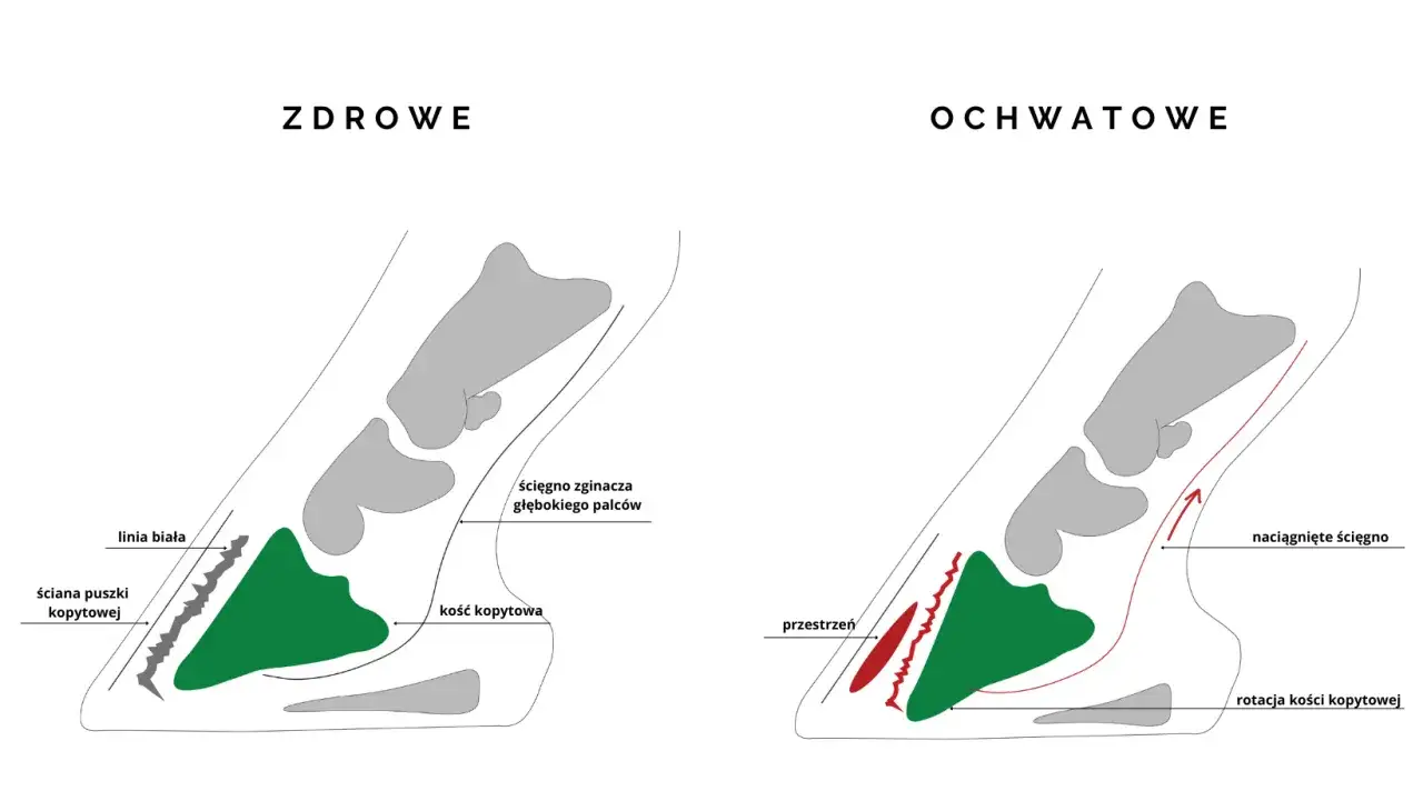 Zdrowe kopyto vs. ochwatowe: porównanie anatomii. Ochwat co to? Ilustracja pokazuje rotację kości kopytowej i naciągnięte ścięgno przy ochwacie.